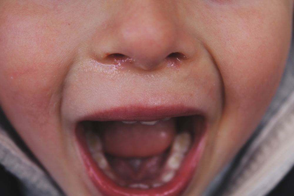 Sådan informerer du om dental fræsning