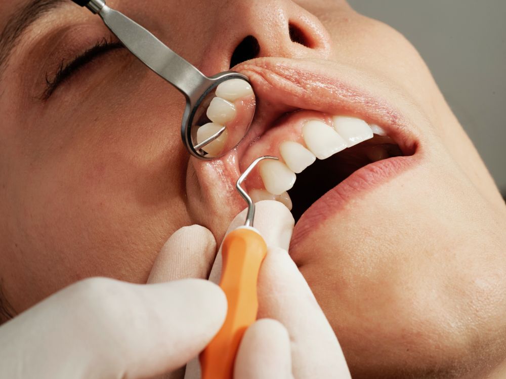 Få den bedste tandbehandling hos din tandlæge i Ringsted
